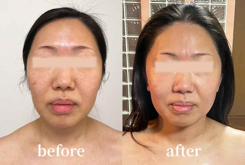 草加 顔ジム たるみ